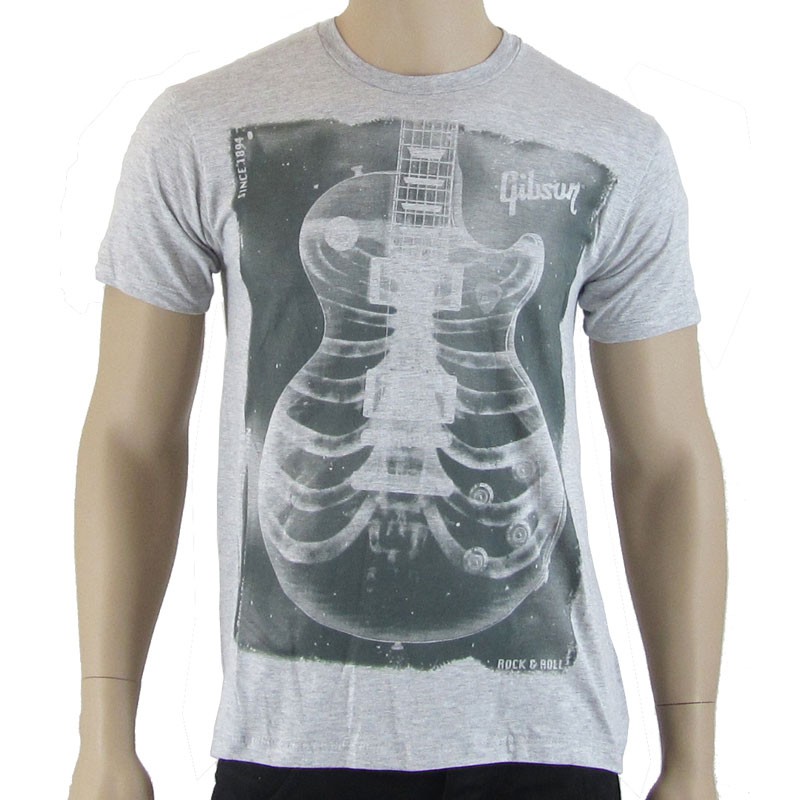 XRay