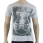 XRay